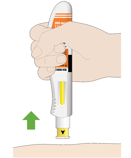 remove pen from skin